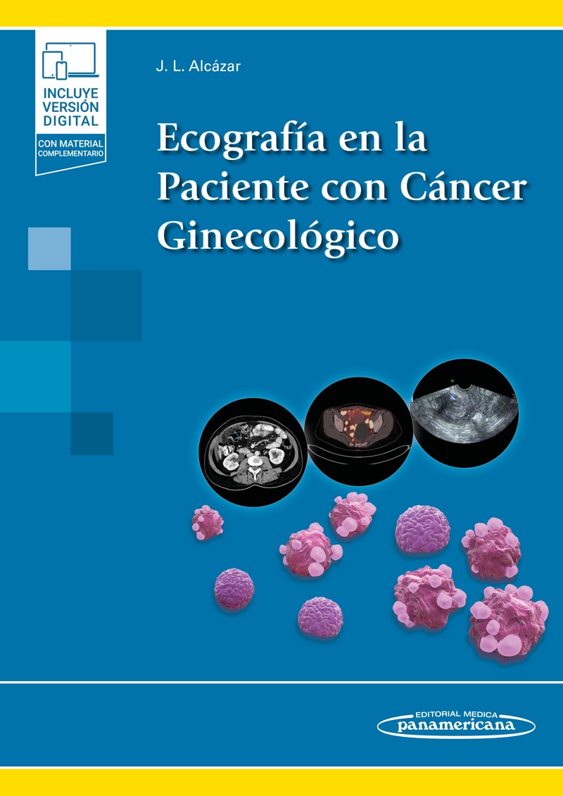 Ecografía En La Paciente Con Cáncer Ginecológico
