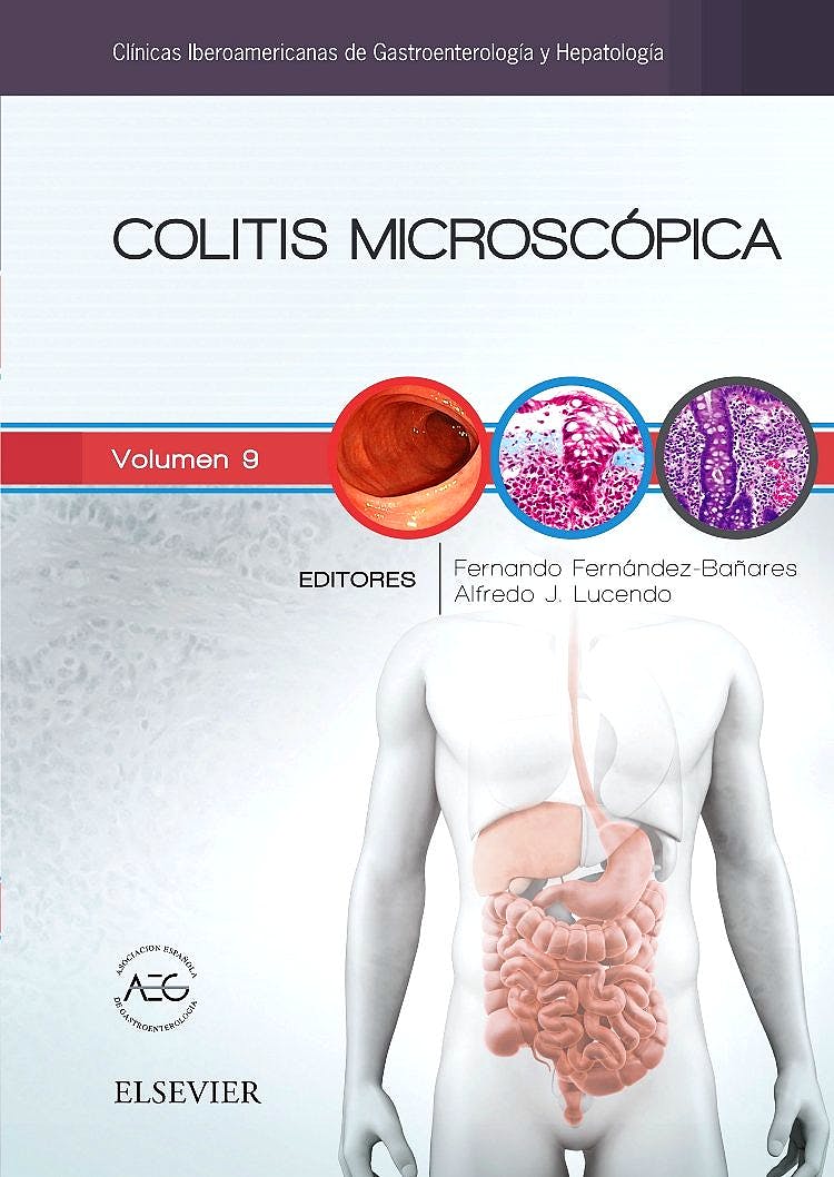 Colitis Microscópica (Clínicas Iberoamericanas De Gastroenterología Y Hepatología, Vol. 9)