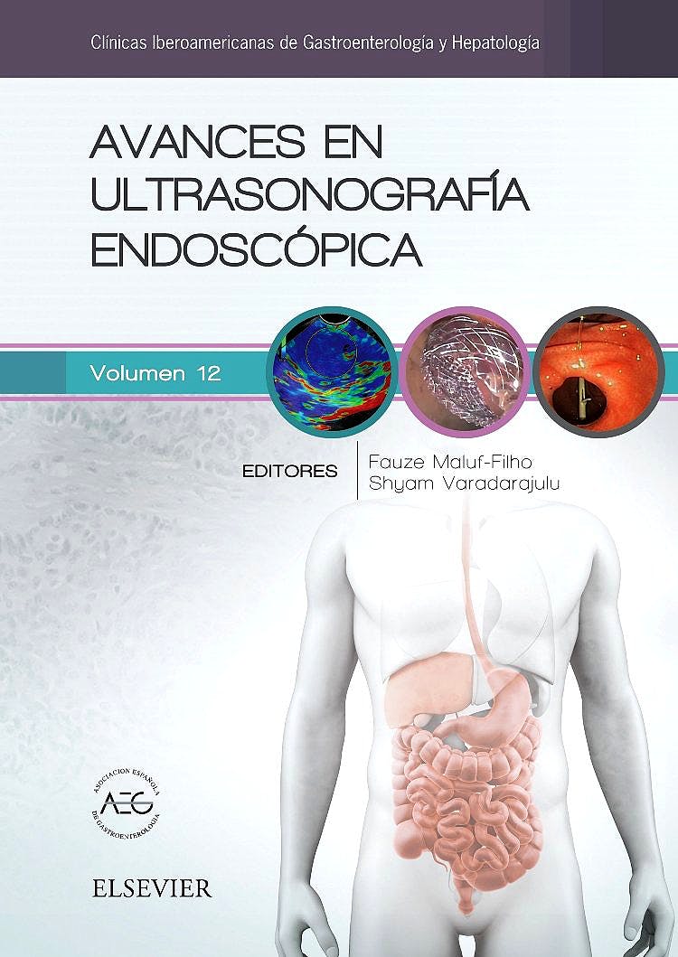 Avances En Ultrasonografía Endoscópica (Clínicas Iberoamericanas De Gastroenterología Y Hepatología, Vol. 12)