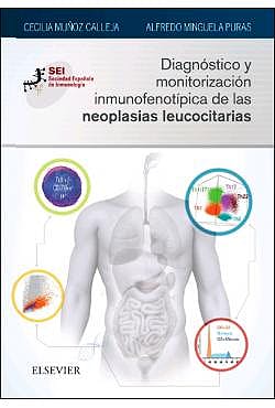 Diagnóstico Y Monitorización Inmunofenotípica De Las Neoplasias Leucocitarias