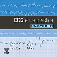 Ecg En La Práctica .