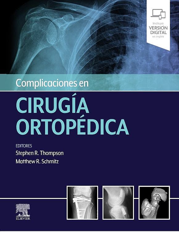 Complicaciones En Cirugía Ortopédica