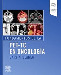 Fundamentos De La Pet-Tc En Oncología