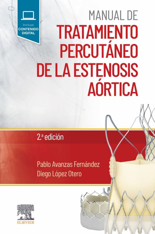 Manual De Tratamiento Percutáneo De La Estenosis Aórtica