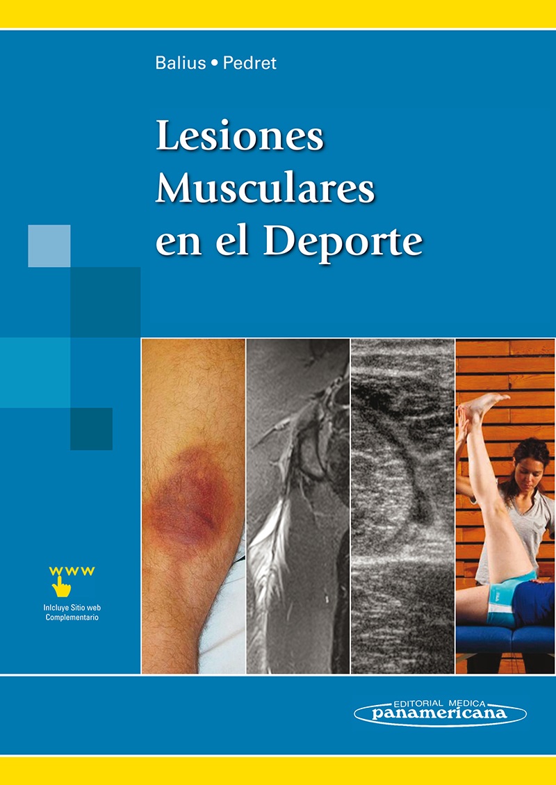 Lesiones Musculares En El Deporte