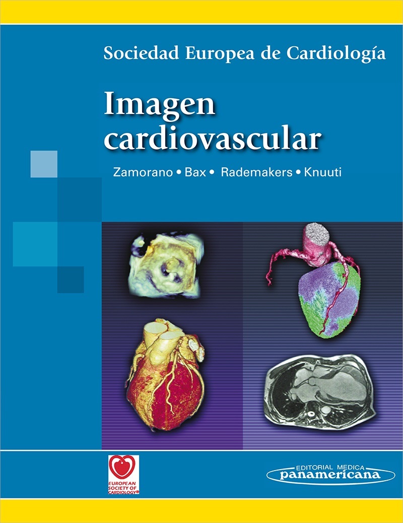 Imagen Cardiovascular