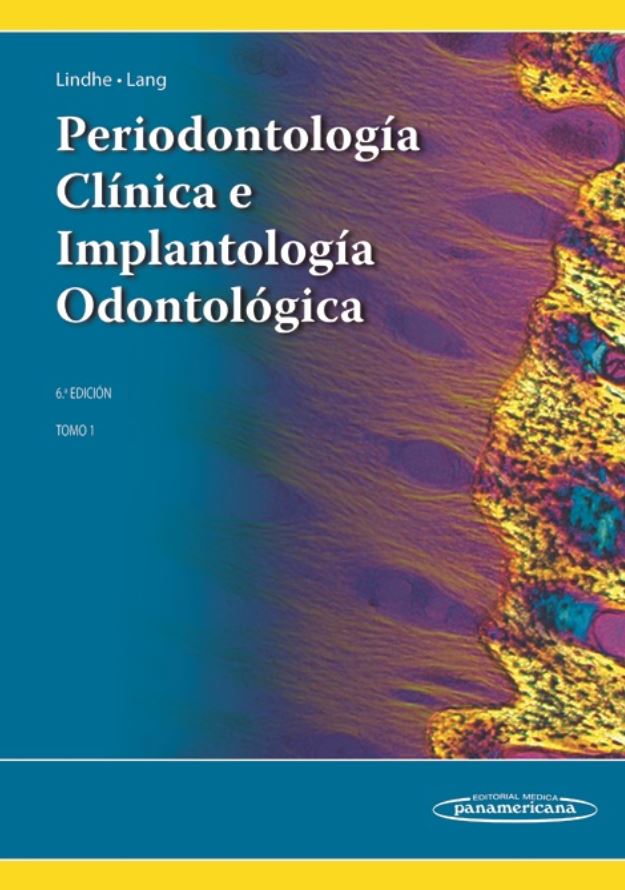 Periodontología Clínica E Implantología Odontológica