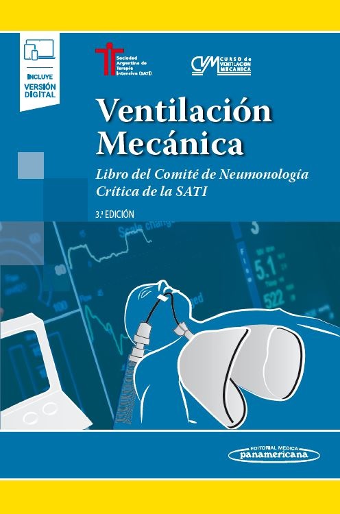 Ventilación Mecánica