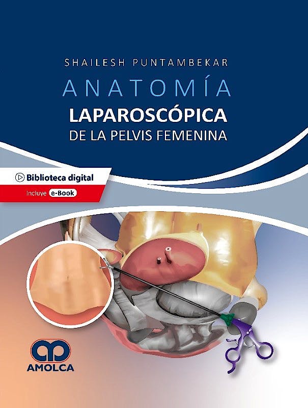 Anatomía Laparoscópica de la Pelvis Femenina