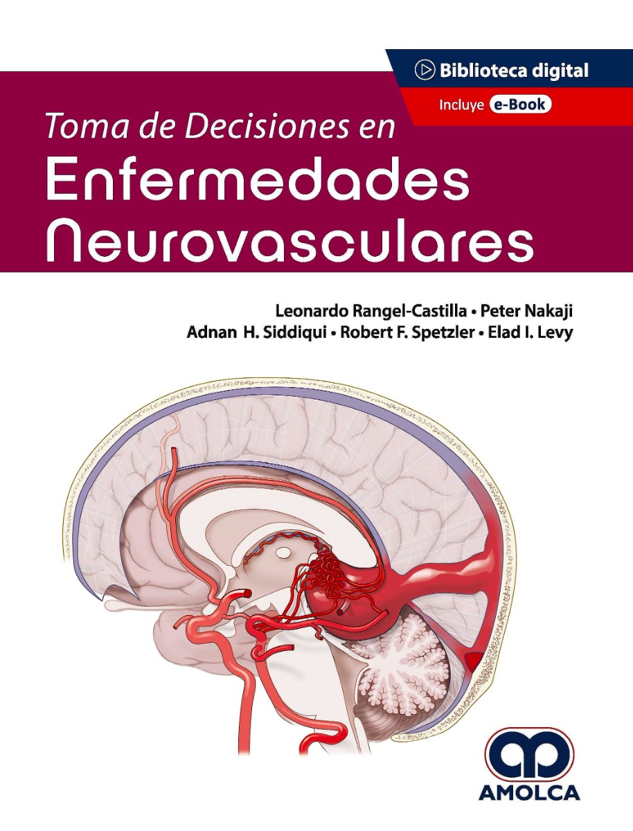 Toma de Decisiones en Enfermedades Neurovasculares