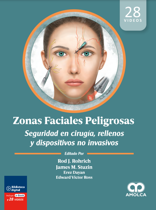 Zonas Faciales Peligrosas.