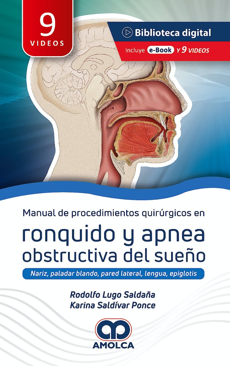 Manual de Procedimientos Quirúrgicos en Ronquido y Apnea Obstructiva del Sueño