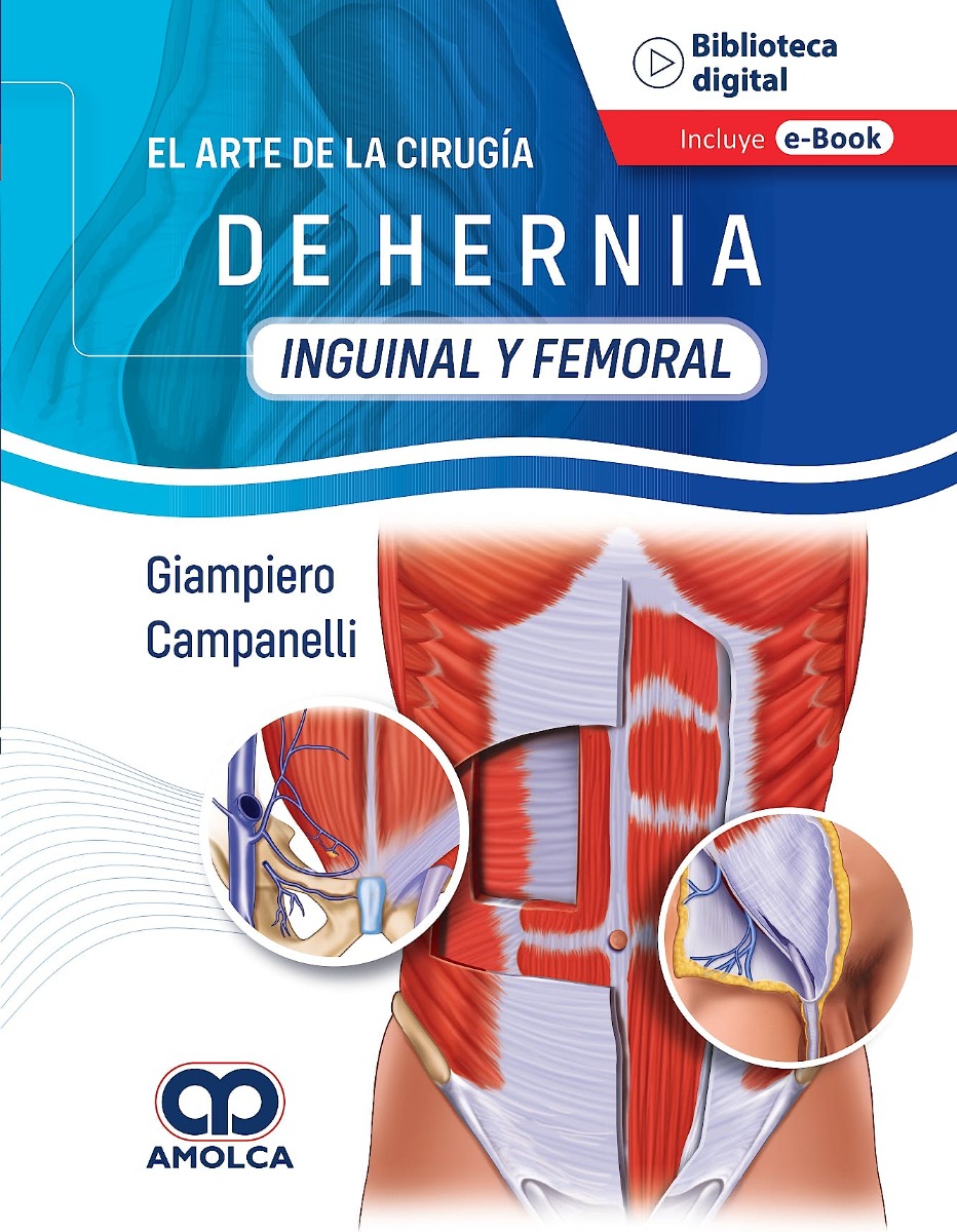 El Arte de la Cirugía de Hernia