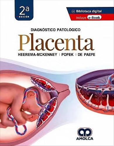 Diagnóstico Patológico. Placenta