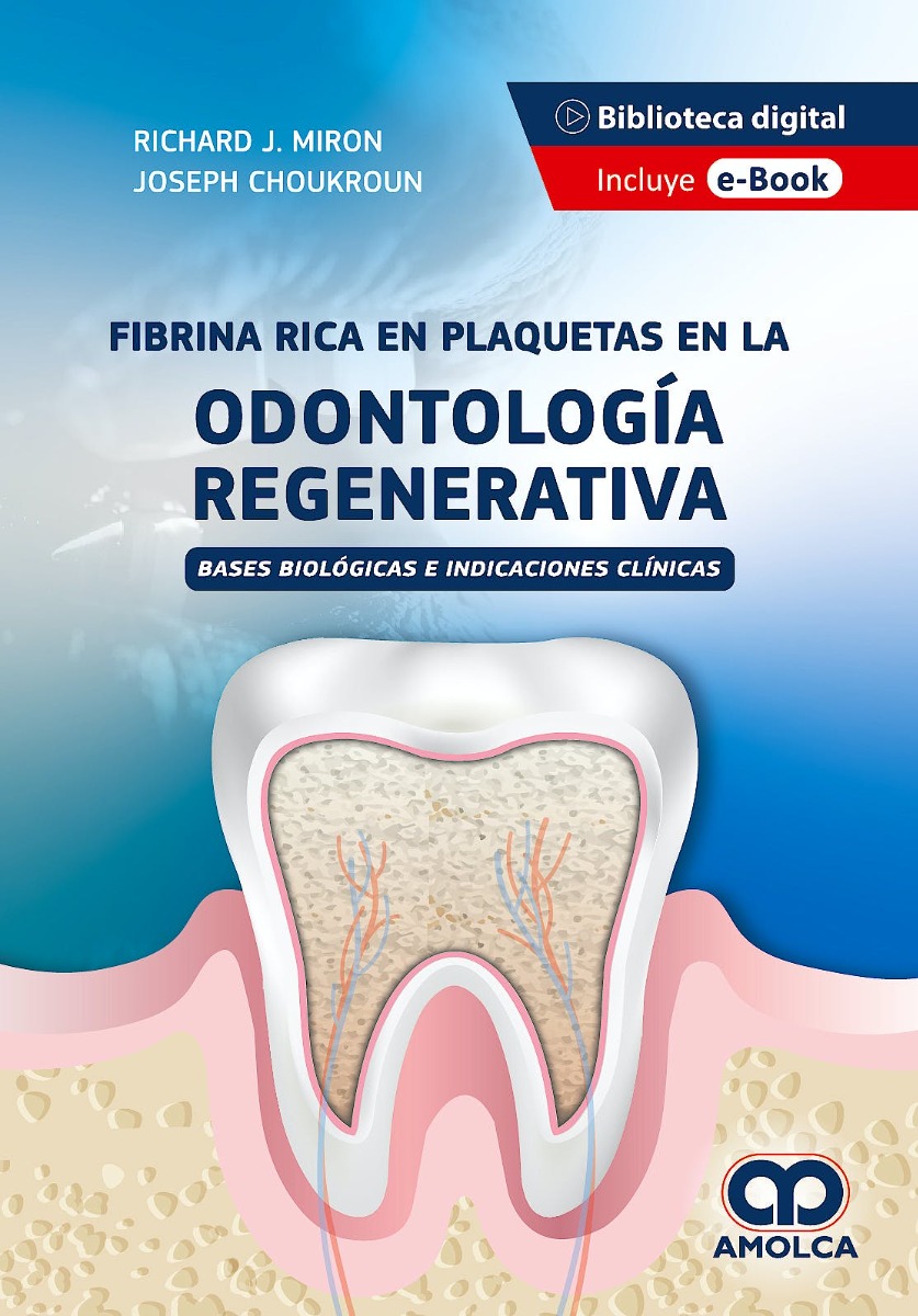 Fibrina Rica en Plaquetas en la Odontología Regenerativa