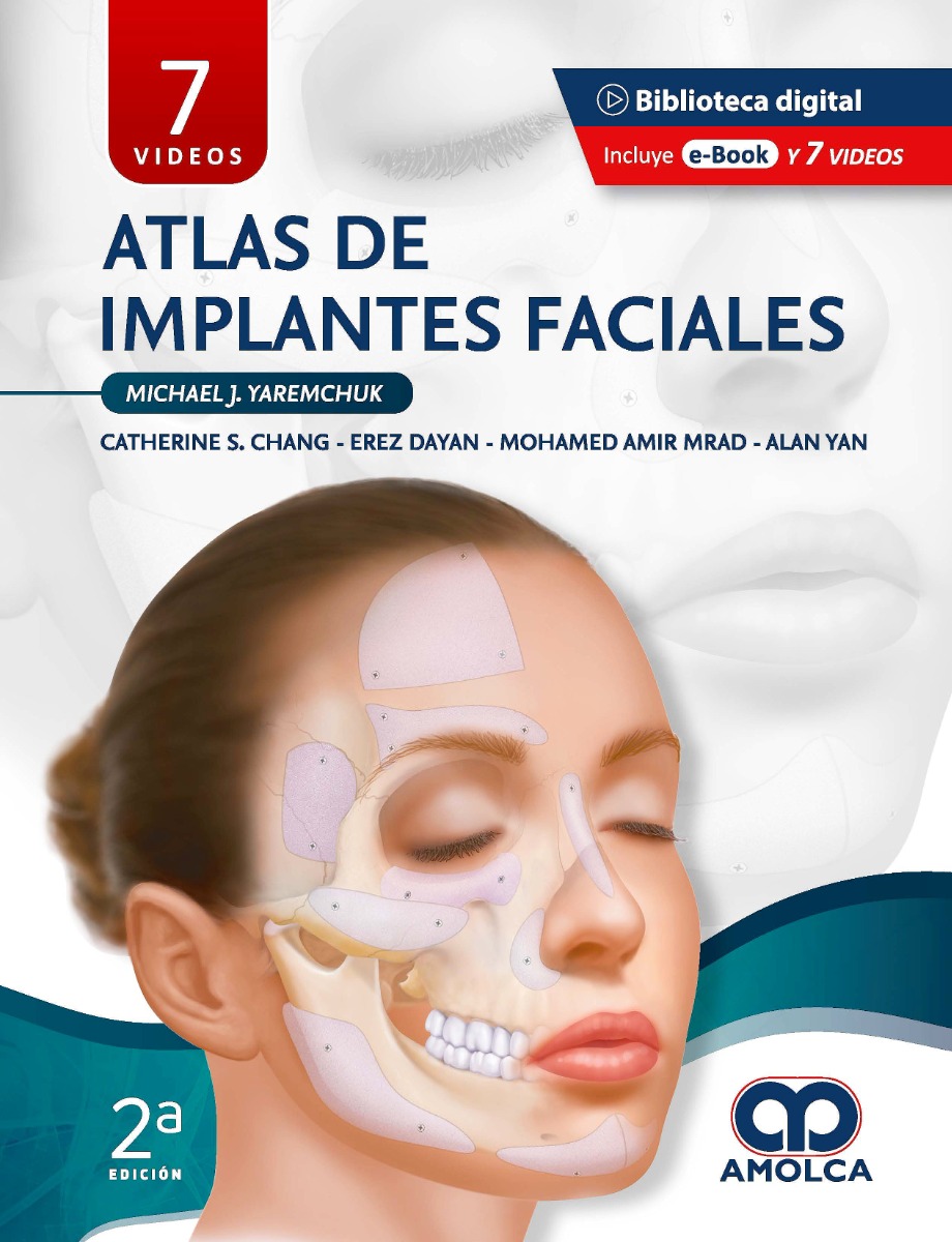Atlas de Implantes Faciales