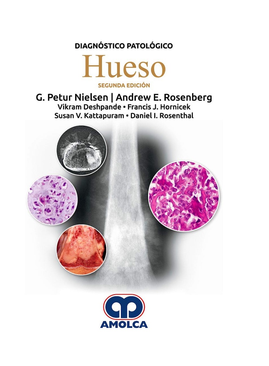 Diagnóstico Patológico. Hueso
