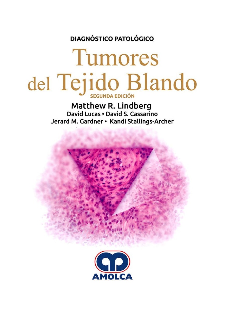 Diagnóstico Patológico. Tumores del Tejido Blando