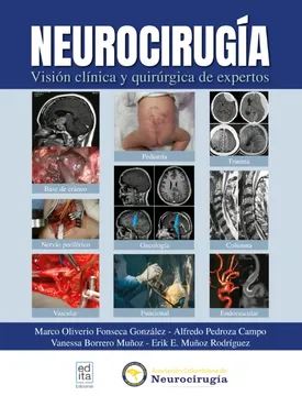 Neurocirugía. Visión Clínica y Quirúrgica de Expertos