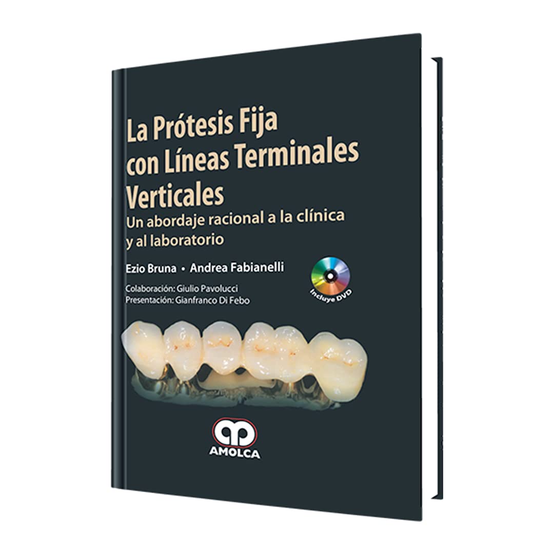 La Prótesis Fija con Líneas Terminales Verticales