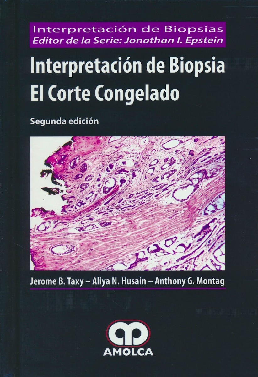Interpretación de Biopsia. El Corte Congelado (Interpretación de Biopsias)