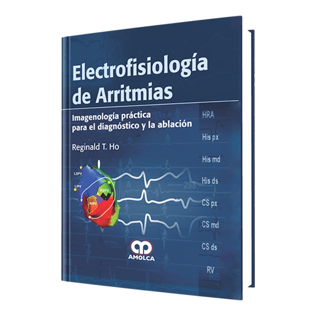 Electrofisiología de Arritmias
