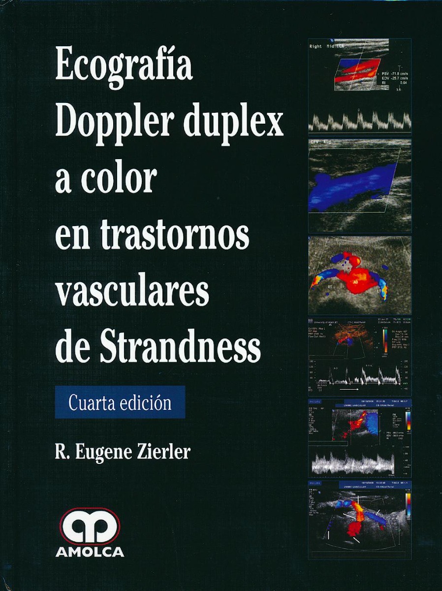Ecografía Doppler Duplex a Color en Trastornos Vasculares de Strandness
