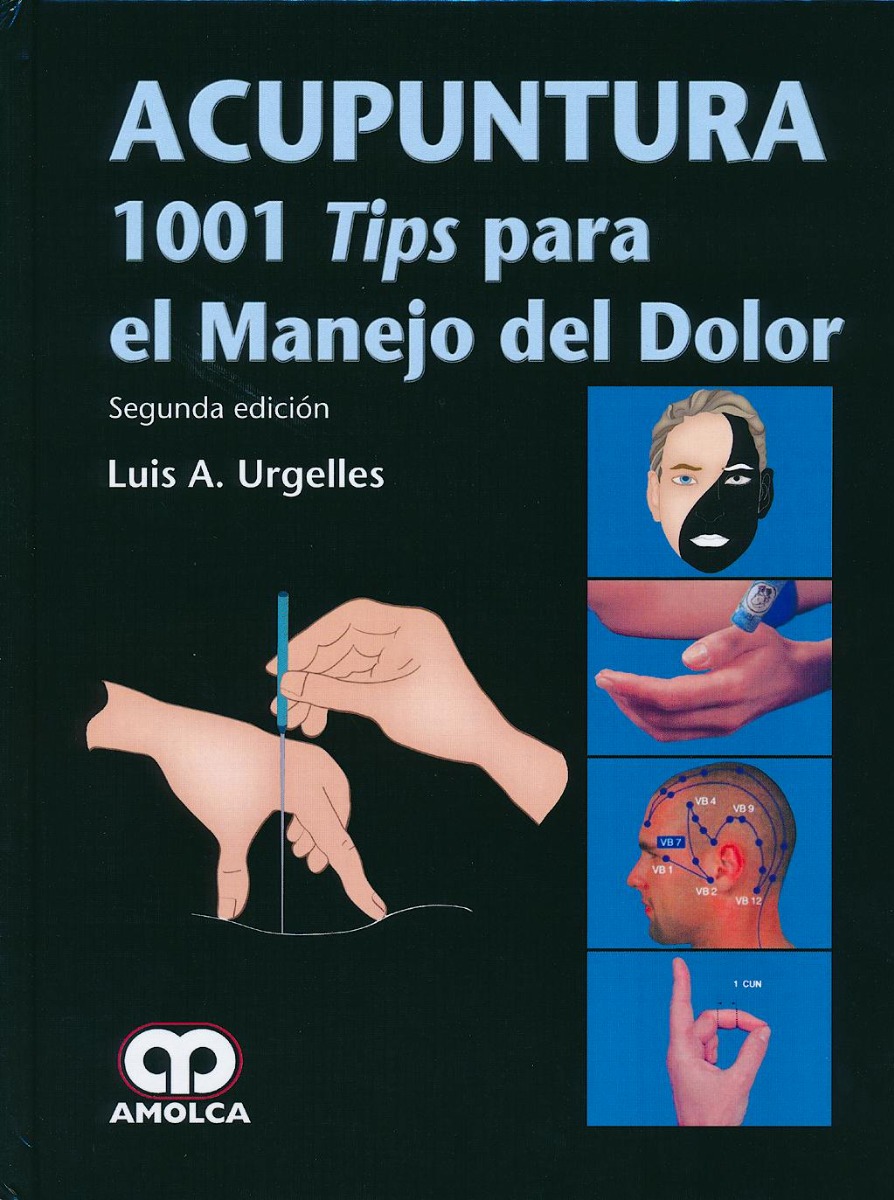 Acupuntura. 1001 Tips para el Manejo del Dolor