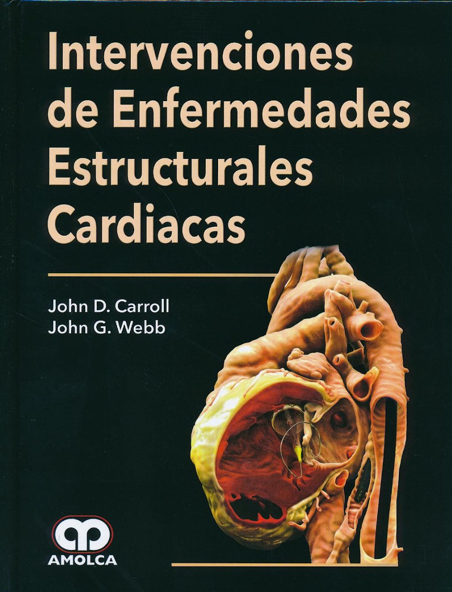 Intervenciones de Enfermedades Estructurales Cardiacas
