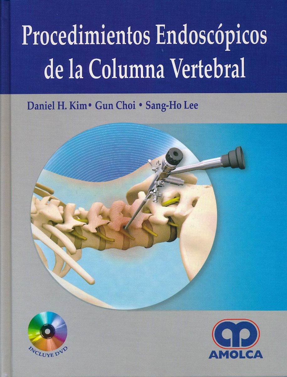 Procedimientos Endoscópicos de la Columna Vertebral