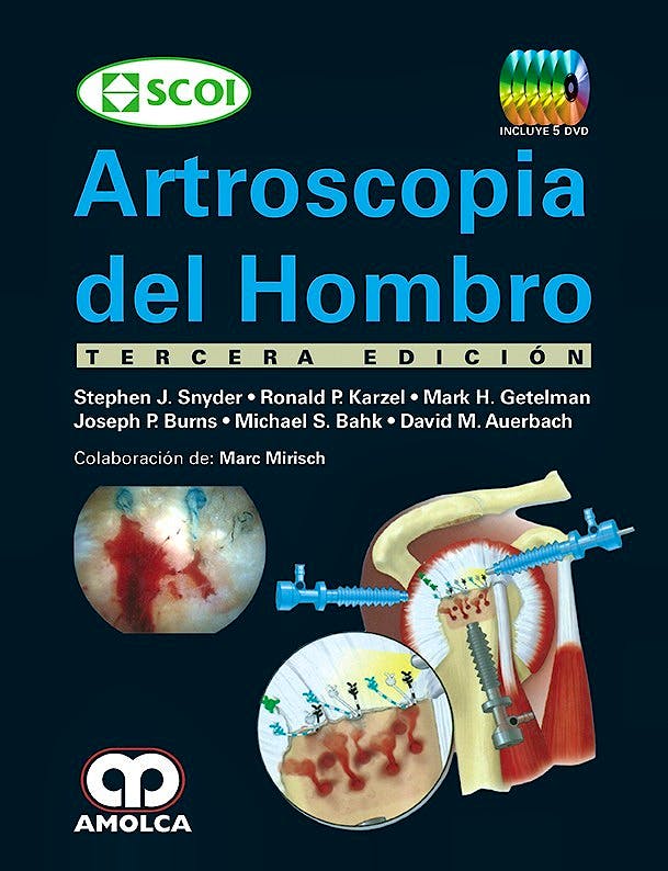 Artroscopia del Hombro