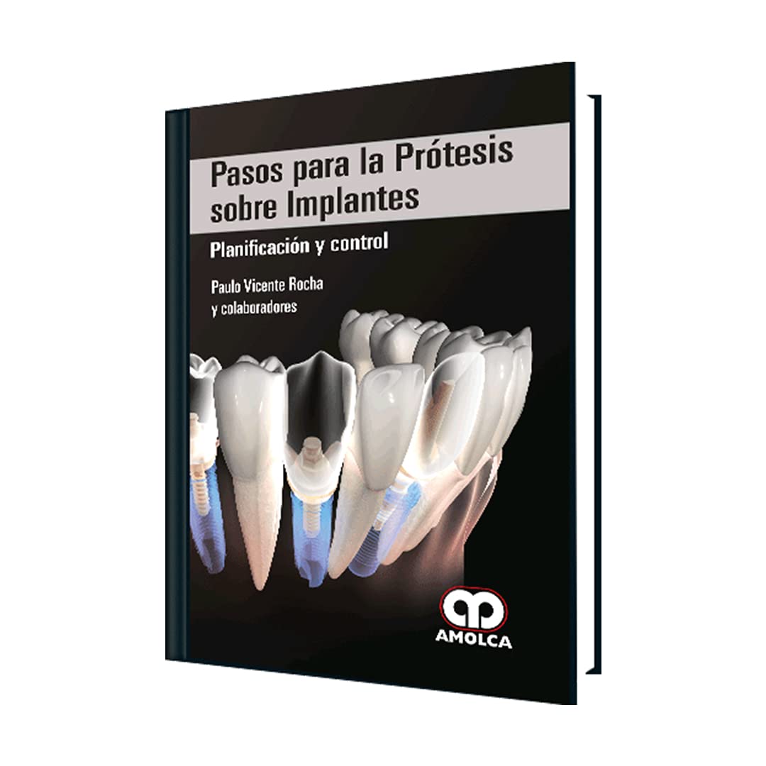 Pasos para la Prótesis sobre Implantes