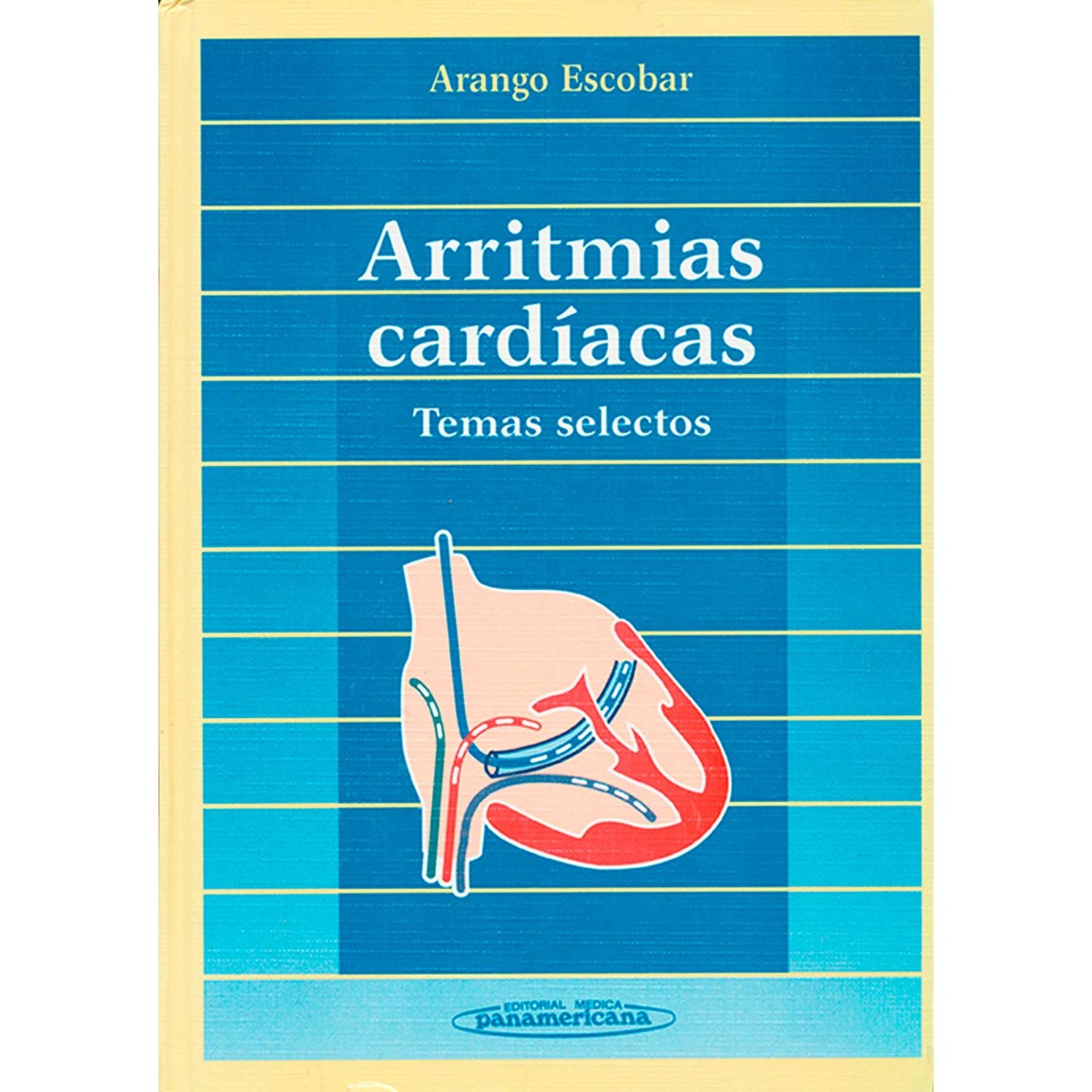 Arritmias Cardiacas