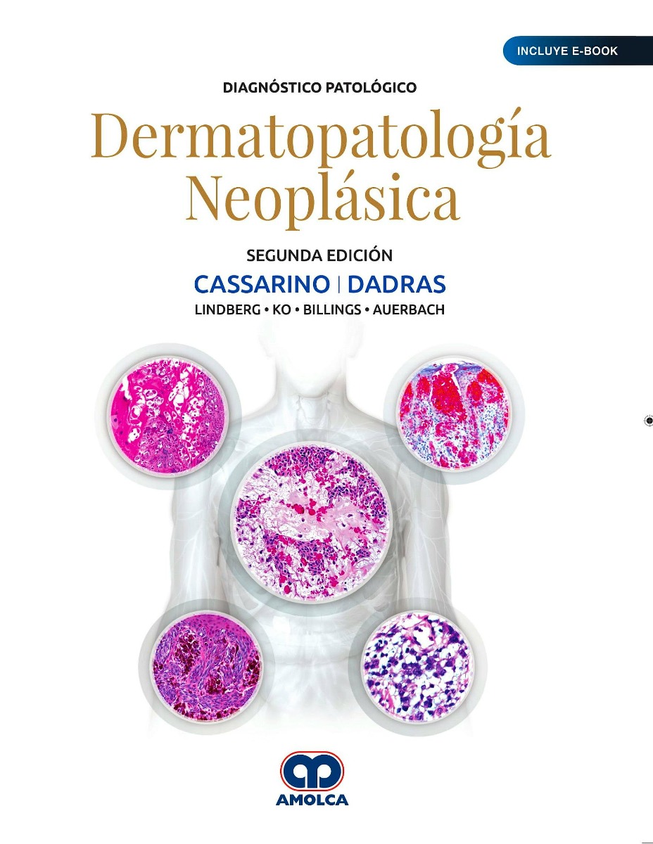 Diagnóstico Patológico. Dermatopatología Neoplásica