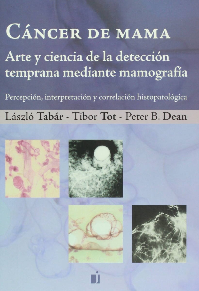 Cancer de mama. Arte y Ciencia