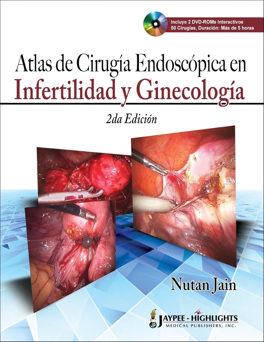 Atlas de Cirugía Endoscópica en Infertilidad Ginecológica