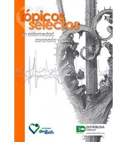 Tópicos Selectos En Enfermedad Coronaria