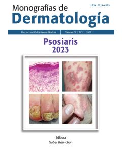 Monografías De Dermatología Psoriasis