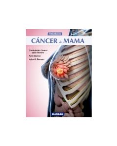 Handbook Cáncer De Mama