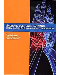 Sindrome Del Tunel Carpiano