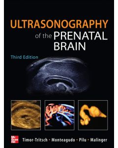 Ultrasonography of the Prenatal Brain