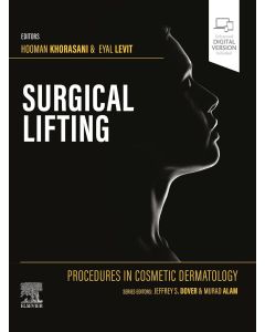 Surgical Lifting