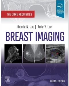 Breast Imaging