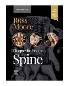 Diagnostic Imaging: Spine