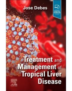 Treatment and Management of Tropical Liver Disease