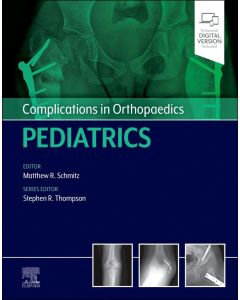 Complications in Orthopaedics: Pediatrics