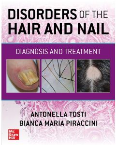 Disorders of the Hair and Nail: Diagnosis and Treatment