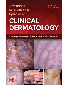 Fitzpatrick's Color Atlas and Synopsis of Clinical Dermatology