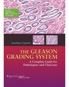 The Gleason Grading System