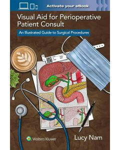 Visual Aid for Perioperative Patient Consult.